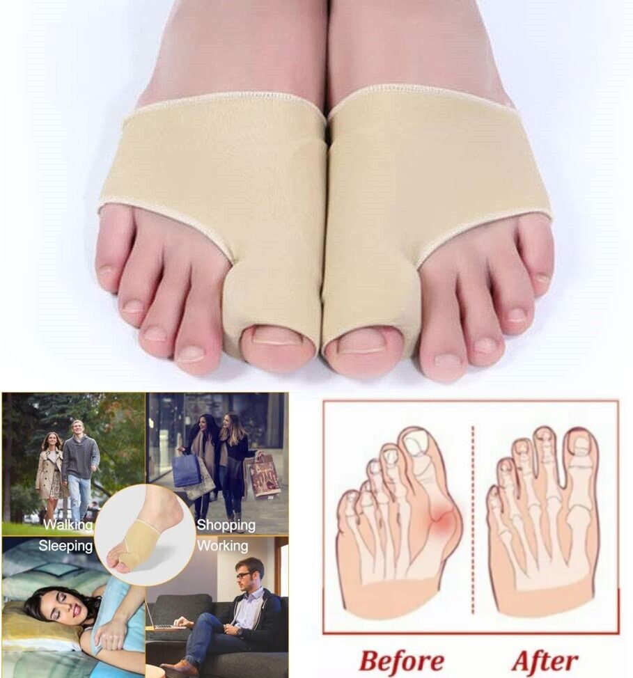 big-toe-bunion-corrector-for-pain-relief-orthopedic-foot-care